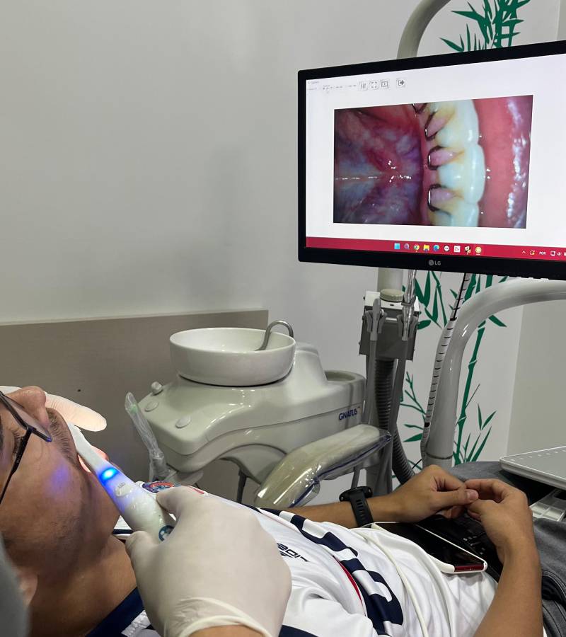 câmera Intraoral